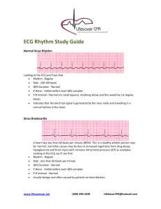 ECG-Rythum-Study-Guide