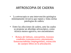 ARTROSCOPIA DE CADERA