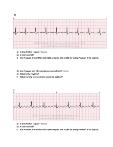 EKG practice strips #2