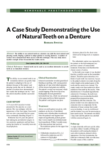 A Case Study Demonstrating the Use of Natural Teeth on a Denture
