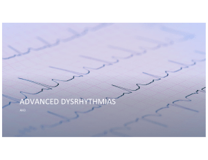 Advanced Dysrhythmia 