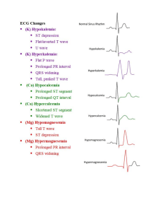 Heart Rhythms