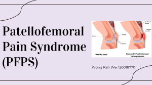 MS Patellofemoral Pain Syndrome