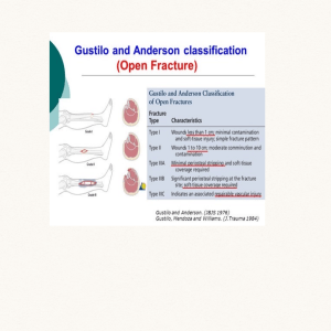 Open fracture classification 