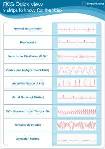 EKG Quick View