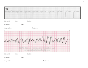 ECG worksheet