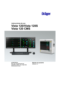 Monitor Vista120