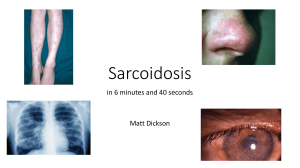 Sarcoidosis PK (2) (1)