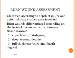 Burn Injuries and Its Management