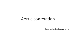 Aortic Coartation