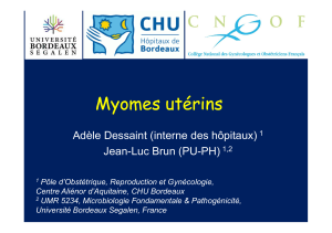 physiopathologie epidemiologie-et-traitements-des-fibromes-uterins Pr-Jean-Luc-Brun CHU-Bordeaux