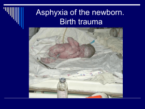 Lecture. Asphyxia. Birth trauma