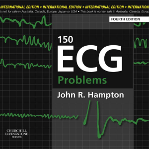 150 ECG Problems: Textbook on ECG Interpretation