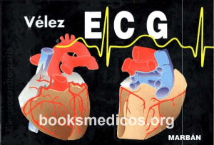 Pautas de ECG Velez 2ª Ed