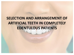 Artificial Teeth Selection & Arrangement