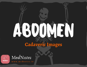 Abdominal Wall - Peritoneum [Free Version]