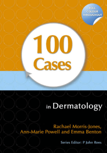 《100 Cases in Dermatology》