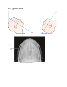 SMV Zygomatic Arches: Radiography Technique & X-Ray Example