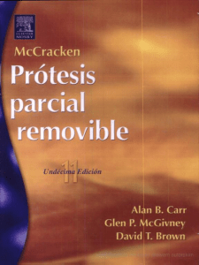 Protesis - McCracken