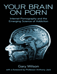 Your brain on porn  internet pornography and the emerging science of addiction