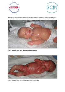 representative photographs of collodion membrane and harlequin ichthyosis 0