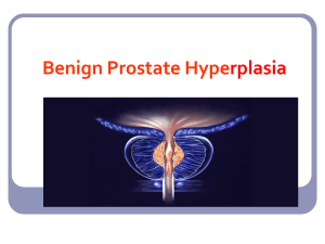 Benign Prostate Hyperplasia: Causes, Symptoms, & Treatment