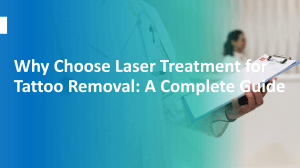 Why Choose Laser Treatment for Tattoo Removal