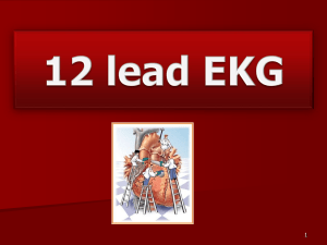 7 12 Lead EKG powerpoint PATHO