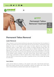 Opt for permanent tattoo removal treatment in andheri west