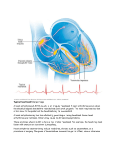 Typical heartbeatEnlarge image