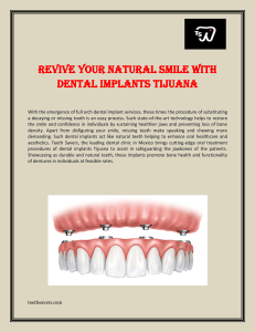 Revive your natural smile with dental implants Tijuana