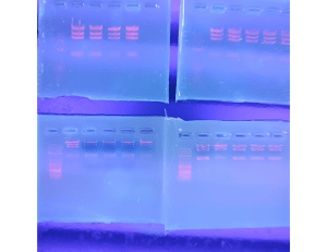 Gel Electrophoresis Image