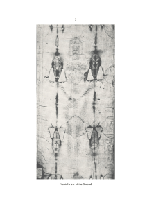 Shroud of Turin: A Forensic Pathologist's View