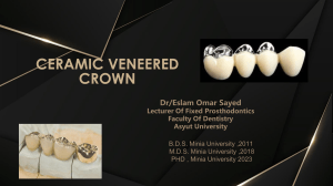 Ceramic Veneered Crowns: A Comprehensive Guide