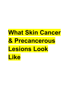 Skin Cancer & Precancerous Lesions: What to Look For