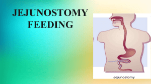 Jejunostomy Feeding: Procedure, Types, Indications & Care