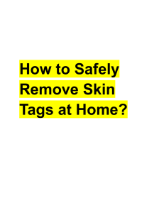 Safely Remove Skin Tags at Home: A Guide