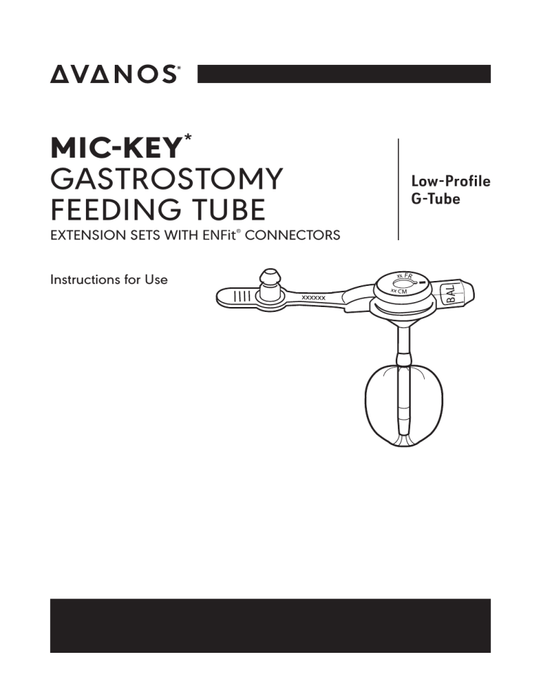 MIC-KEY Gastrostomy Feeding Tube Instructions