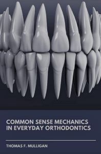 Orthodontic Mechanics: Understanding Forces, Moments & Archwire Resiliency