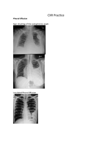 CXR Practice: Pleural Effusion, Pneumonia, Edema & More