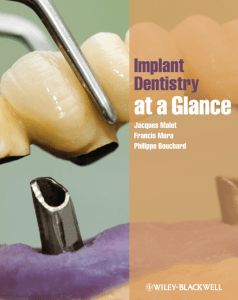Implant Dentistry at a Glance: Textbook