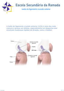 Les&atilde;o do LCA: Causas, Riscos e Preven&ccedil;&atilde;o em Atletas