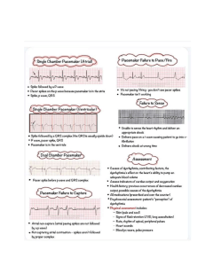 Pacemaker Rhythms & Assessment Cheat Sheet