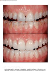 Rehabilitaci&oacute;n Est&eacute;tica Dental: MIPP para Dentici&oacute;n Desgastada
