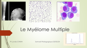 My&eacute;lome Multiple : D&eacute;finition, Diagnostic & Pr&eacute;sentation Clinique