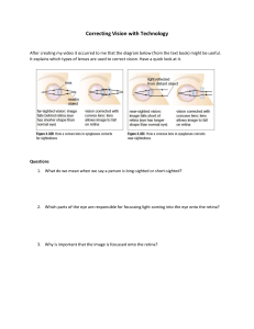 Correcting Vision with Technology: Eye Defects & Lens Correction