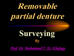 Removable Partial Denture Surveying: Objectives & Procedures