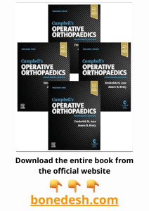 Campbell&rsquo;s Operative Orthopaedics, 4-Volume Set 14th Edition