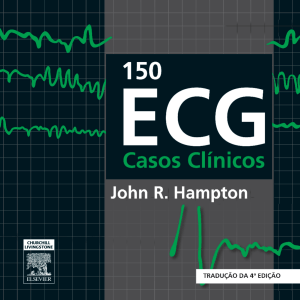 150 Casos Cl&iacute;nicos de ECG