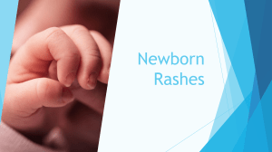 Newborn Rashes: Evaluation & Common Conditions